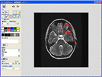 放射線科向けのレポート作成システム