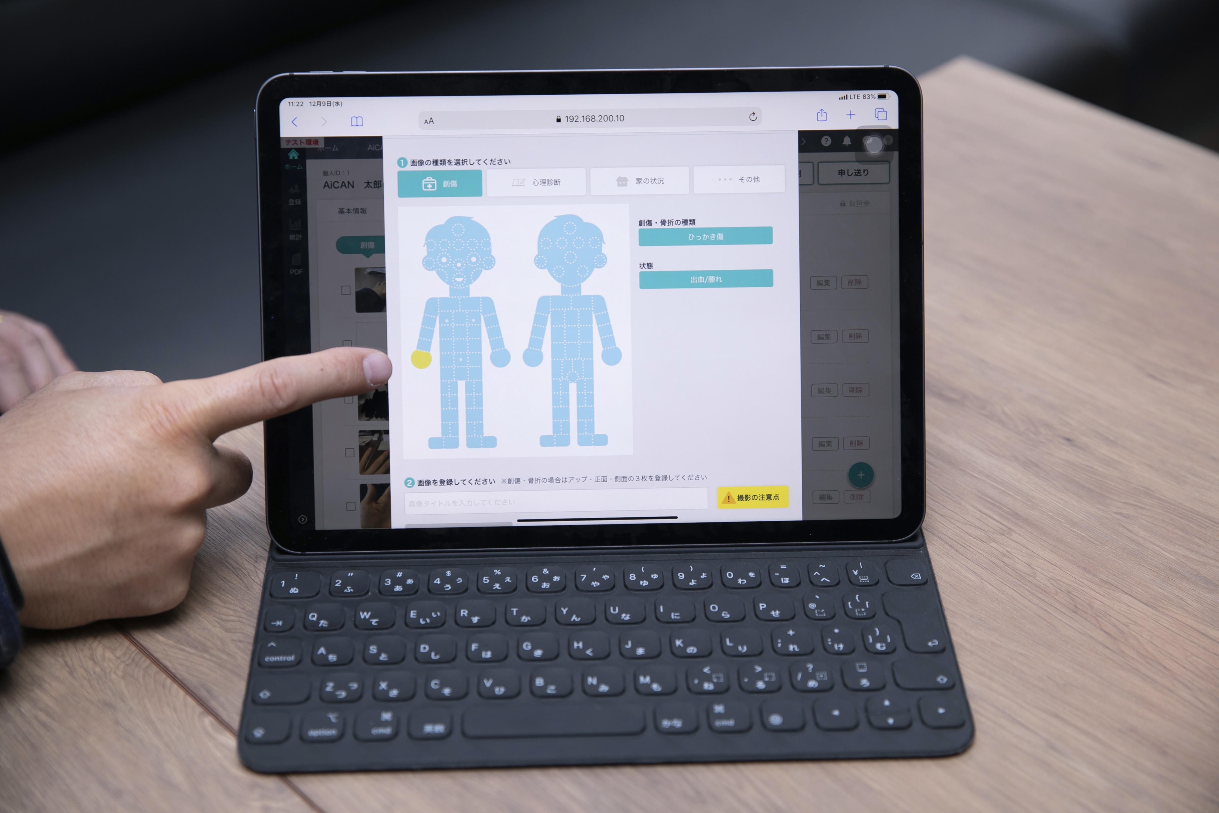 児童相談所や市区町村の子ども虐待対応をサポートするプラットフォーム「AiCAN」。
タブレットで、子どもや親の年齢・性別、その他さまざまなチェック項目を入力していくと、AIが過去のデータをもとにシミュレーションを行う仕組みだ。