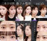 大阪TAクリニック専属SNSマーケター(Instagram運用、撮影等)【ワークライフバランス×美容医療ならではの安定性】