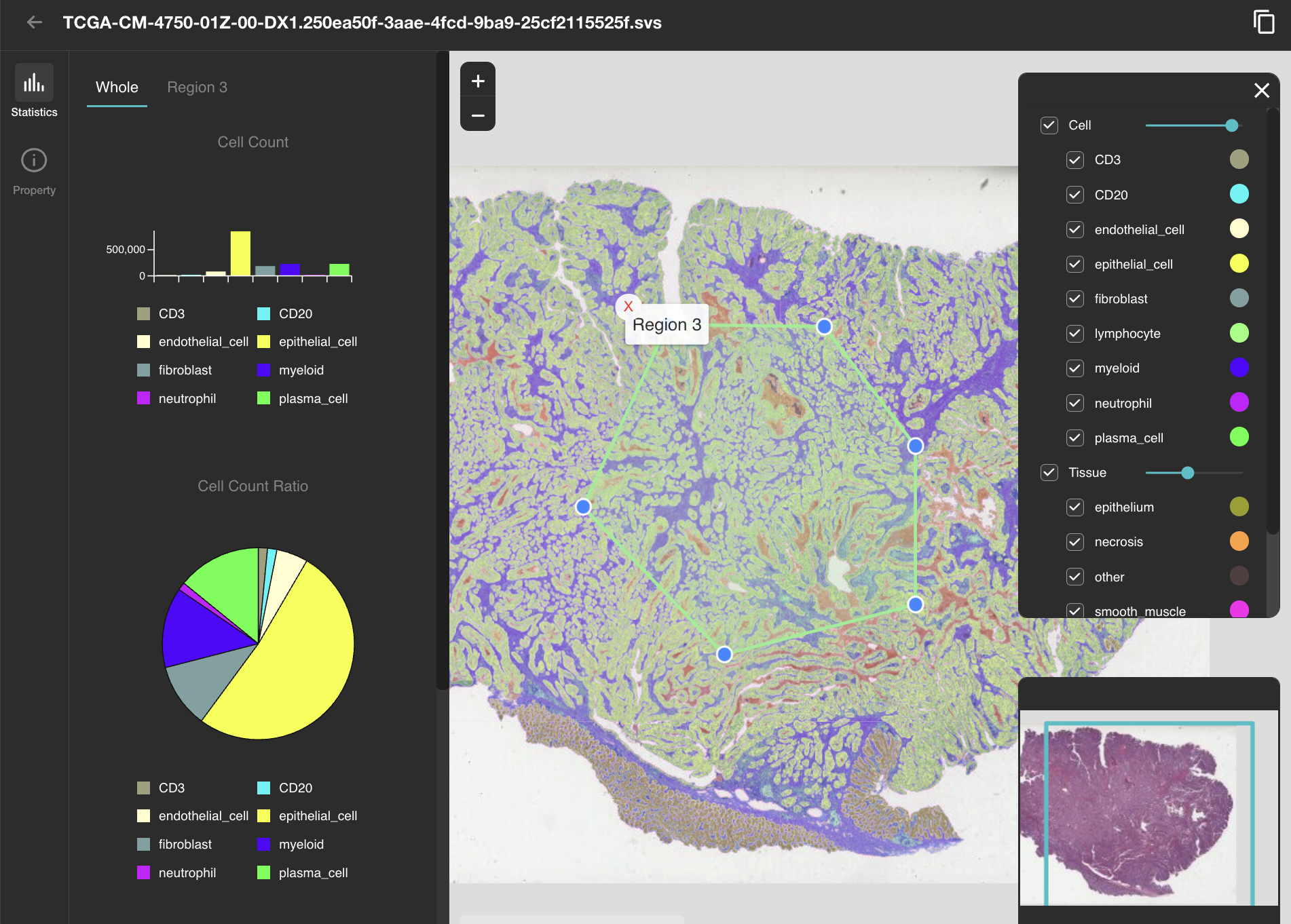 事業内容：個別化医療のための病理画像解析AIプラットフォーム