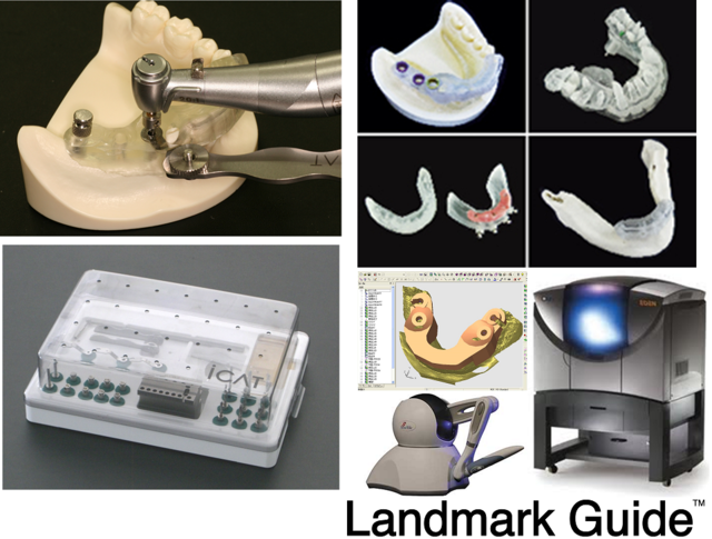 昨今話題の3Dプリンターを5年前から活用